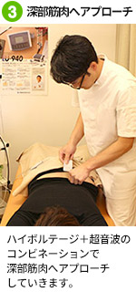 腰痛施術３